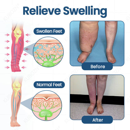 ⚡KUBOZN® Roll-On Cream for Lymphatic Drainage & Swelling Relief