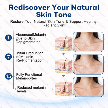 👨‍⚕️🔥Piperine Vitiligo Repigmentation Spray - 🌿Steroid-Free Botanical Formula | Gentle & Effective for All Skin Types
