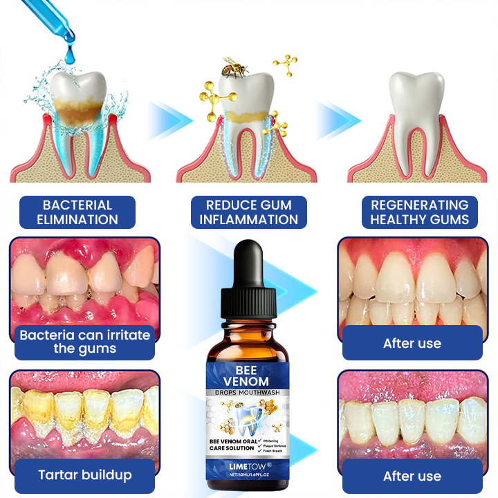 LIMETOW® Bee Venom Oral Care Solution