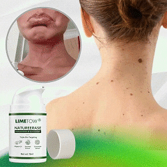 LIMETOW® Instant Mole Spot Cream