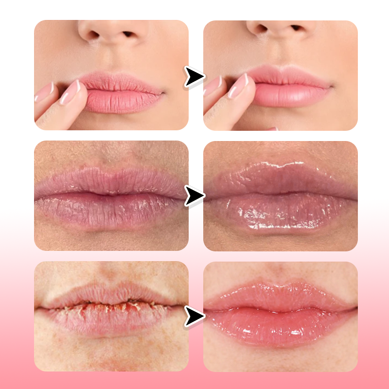 LIMETOW® Lip Softening Serum