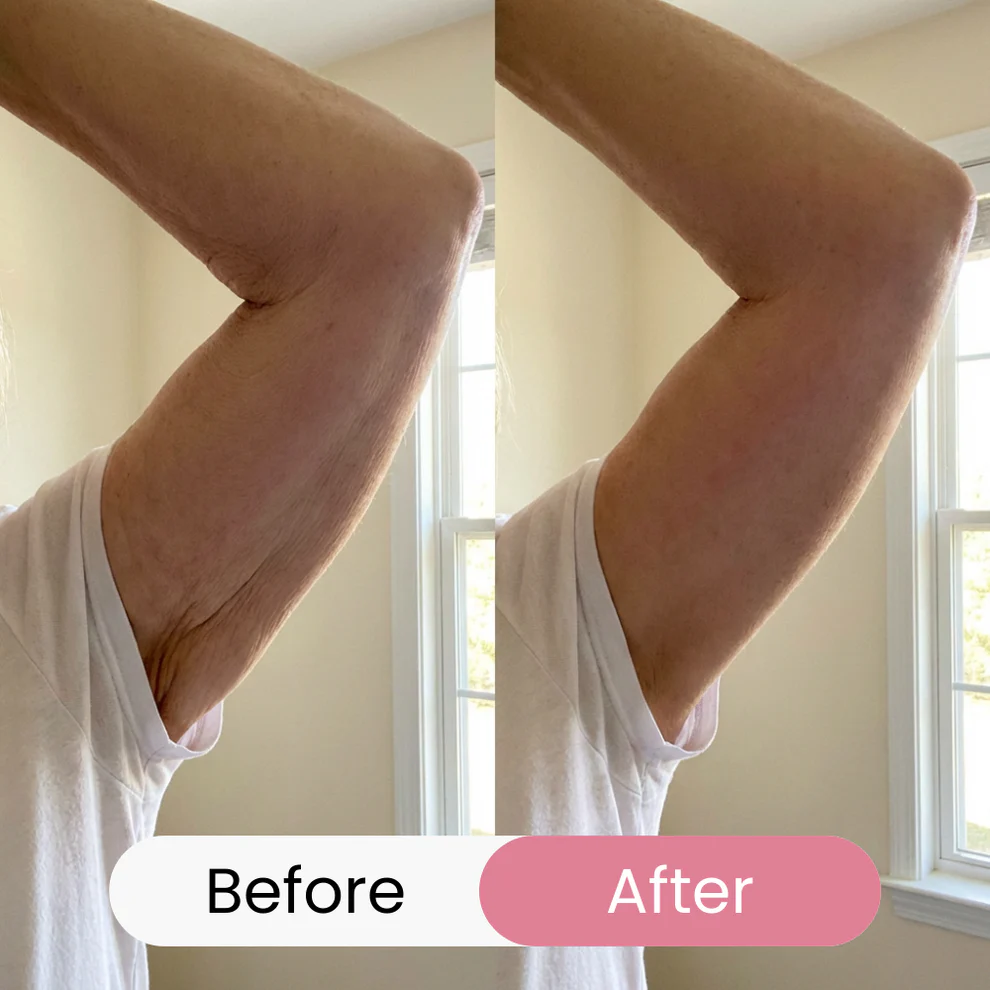 LIMETOW® REVERSE-AGING BODY OIL