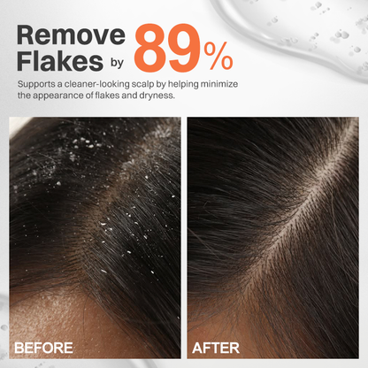 LIMETOW® - Korea's #1 Hair Growth Serum