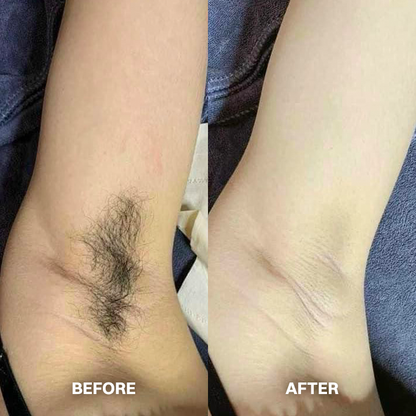 LIMETOW® Cyperus Rotundus Hair Reduction Oil