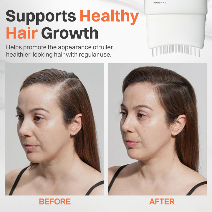 LIMETOW® - Korea's #1 Hair Growth Serum