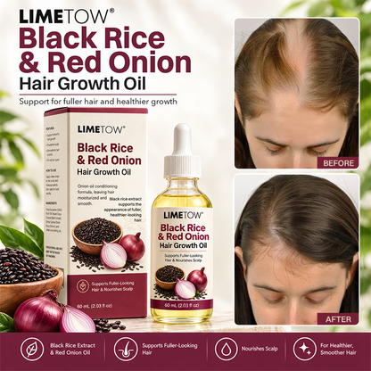 LIMETOW® BLACK RICE & RED ONION HAIR GROWTH OIL! BOTANICAL SUPPORT FOR FULLER HAIR AND HEALTHIER GROWTH!