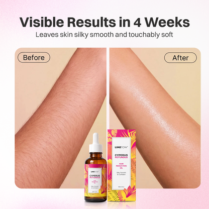 LIMETOW® Cyperus Rotundus Hair Reduction Oil