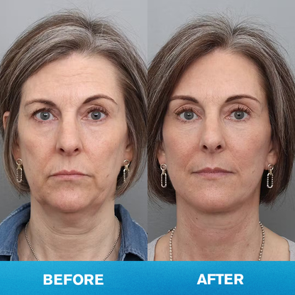 LIMETOW® Invisible Face Lift Tape