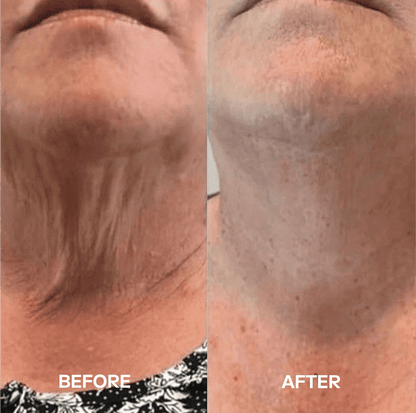 LIMETOW® Neck Masks