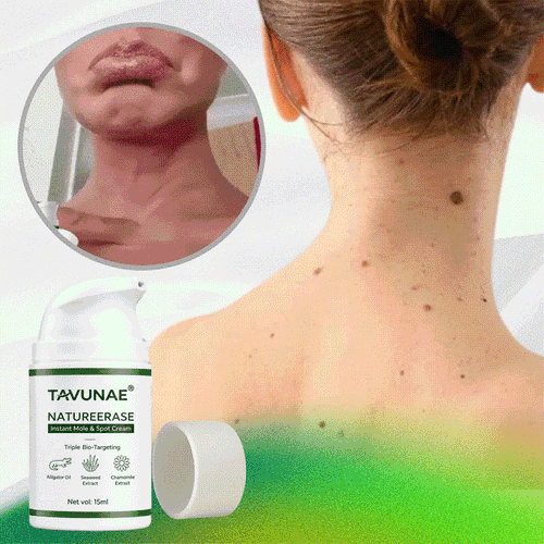 LIMETOW® Instant Mole Spot Cream