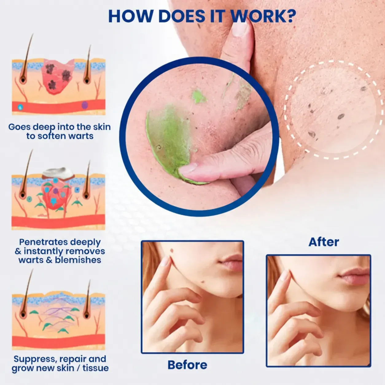 LIMETOW® Instant Mole Spot Cream
