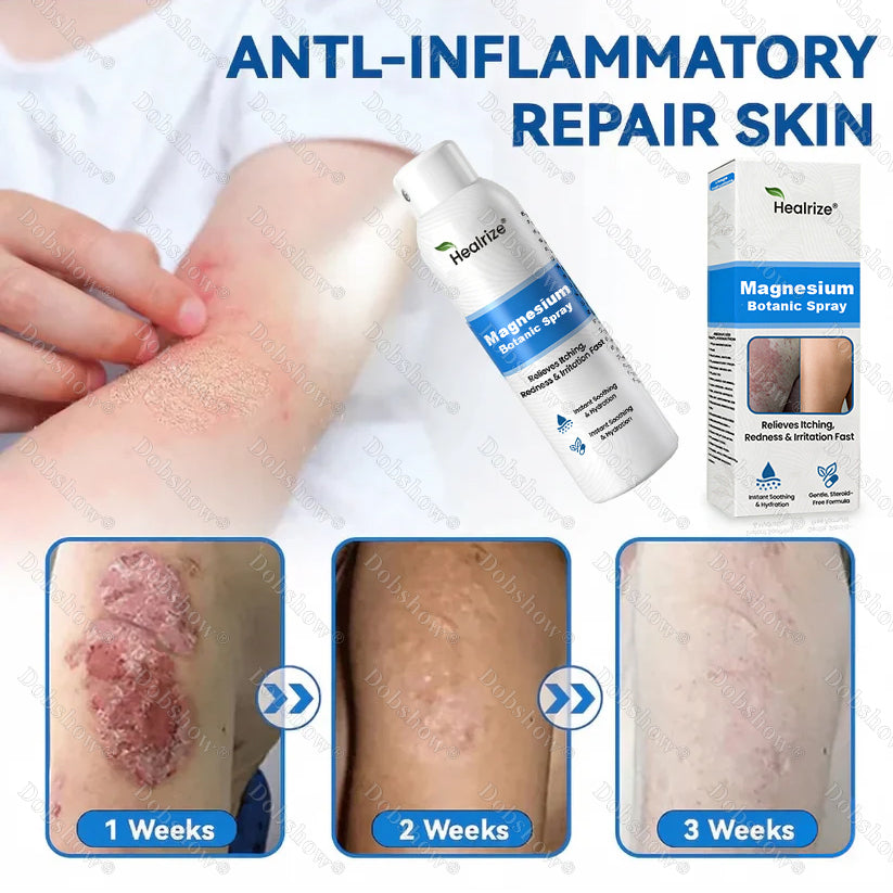 🔥Magnesium Botanic Spray – Advanced Skin Recovery for Psoriasis & Eczema | Rapid Soothing, Steroid-Free