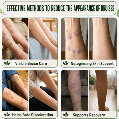 IMETOW® Skin Strengthening Cream– Natural Relief for Bumps, Impacts & Everyday Scrapes