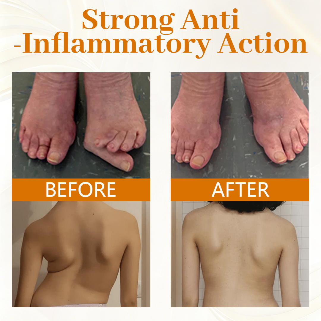 Timilk® ScorpiTakt Joint & Muscle Relief Ointment