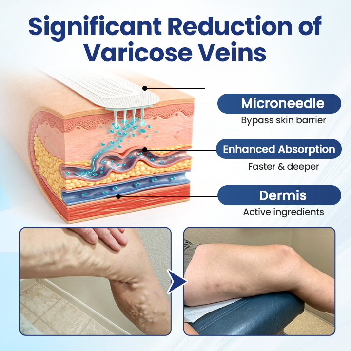Timilk® Deep Vein Repair Microneedle Patch