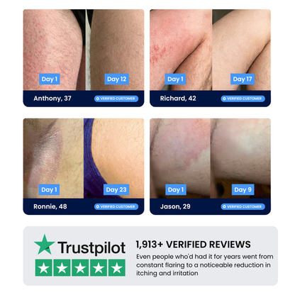 LIMETOW® Anti-Fungal Jock Cream