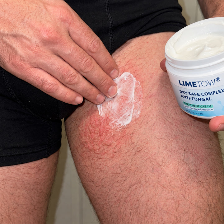 LIMETOW® Anti-Fungal Jock Cream