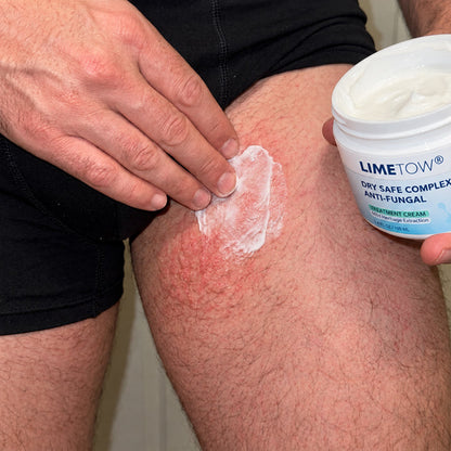 LIMETOW® Anti-Fungal Jock Cream