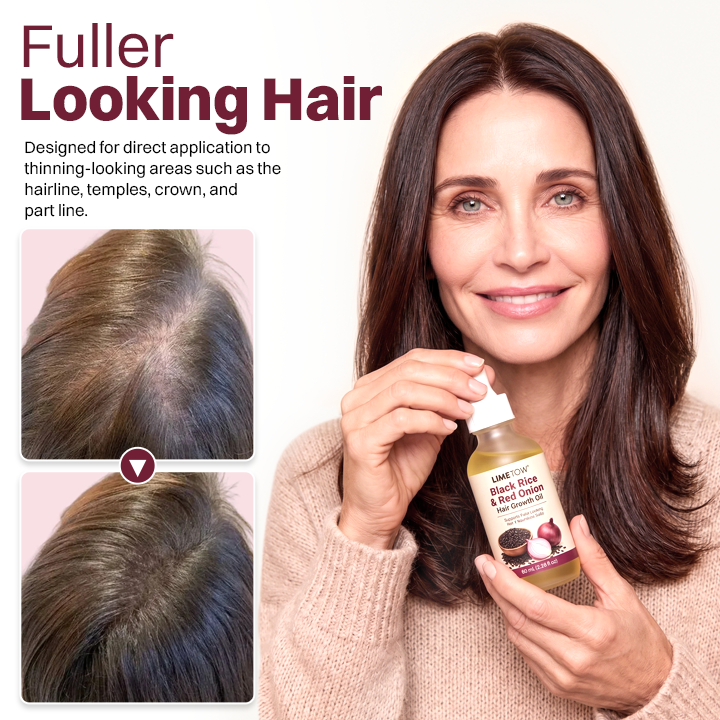 LIMETOW® BLACK RICE & RED ONION HAIR GROWTH OIL! BOTANICAL SUPPORT FOR FULLER HAIR AND HEALTHIER GROWTH!