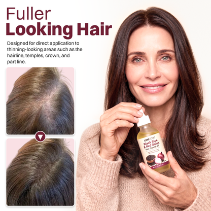 LIMETOW® BLACK RICE & RED ONION HAIR GROWTH OIL! BOTANICAL SUPPORT FOR FULLER HAIR AND HEALTHIER GROWTH!