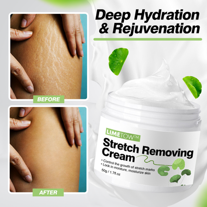 LIMETOW™ Stretch Removing Cream