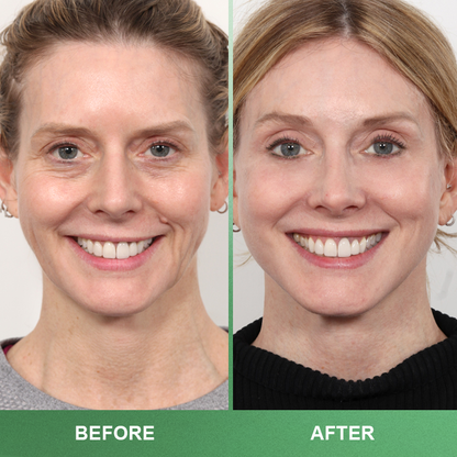 LIMETOW™ Collagen Serum