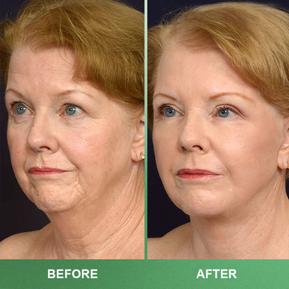 LIMETOW™ Collagen Serum