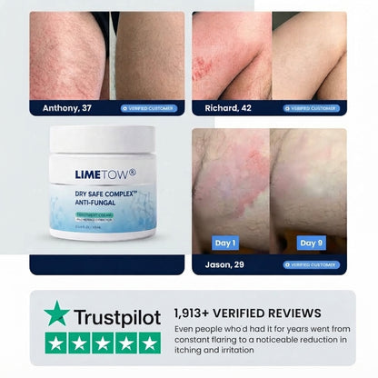 LIMETOW® Anti-Fungal Jock Cream