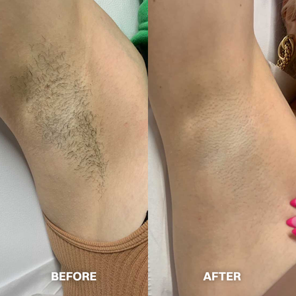 LIMETOW® Hair Removal Cream