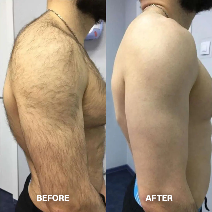 LIMETOW® Hair Removal Cream