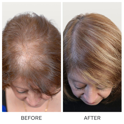 LIMETOW® BLACK RICE & RED ONION HAIR GROWTH OIL! BOTANICAL SUPPORT FOR FULLER HAIR AND HEALTHIER GROWTH!