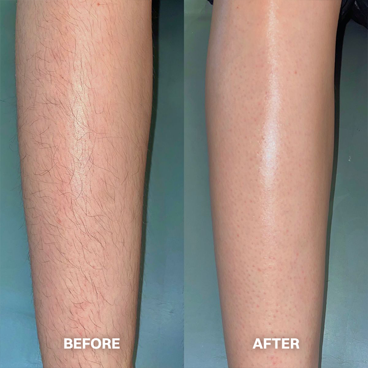 LIMETOW® Hair Removal Cream