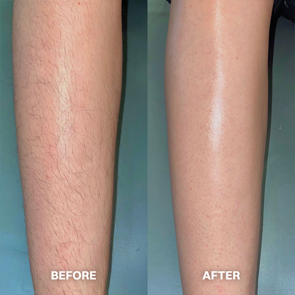 LIMETOW® Hair Removal Cream