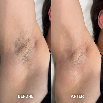 LIMETOW® Hair Removal Cream