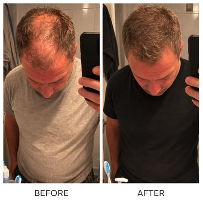 LIMETOW® BLACK RICE & RED ONION HAIR GROWTH OIL! BOTANICAL SUPPORT FOR FULLER HAIR AND HEALTHIER GROWTH!