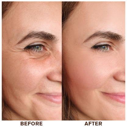 LIMETOW® Instant Eye Cream Tightener✨