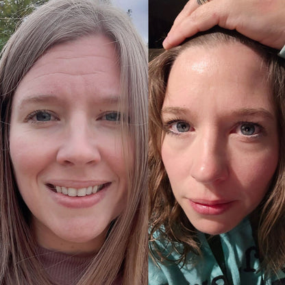 LIMETOW® Forehead & Between the Eyes Facial Patches