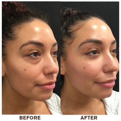 LIMETOW® Instant Eye Cream Tightener✨