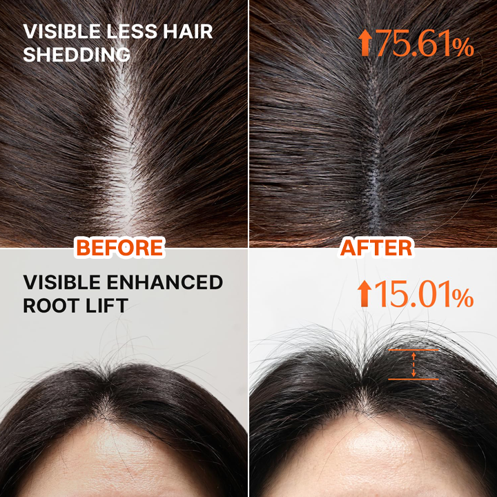 LIMETOW® - Korea's #1 Hair Growth Serum