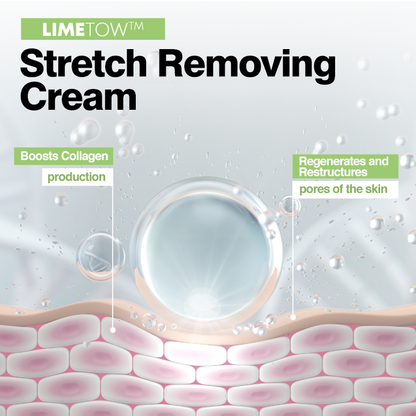 LIMETOW™ Stretch Removing Cream