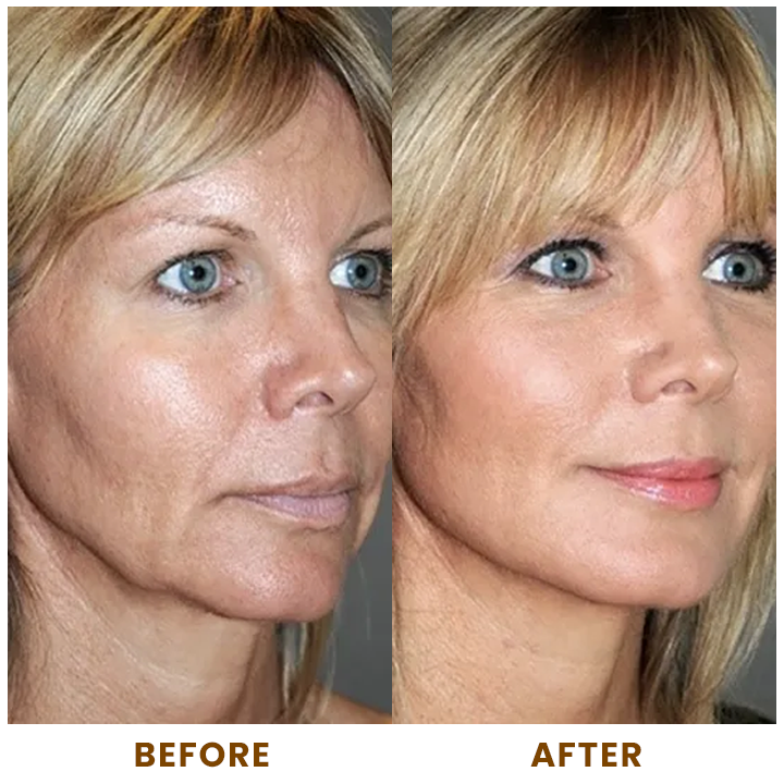 LIMETOW™ Collagen Face Toner