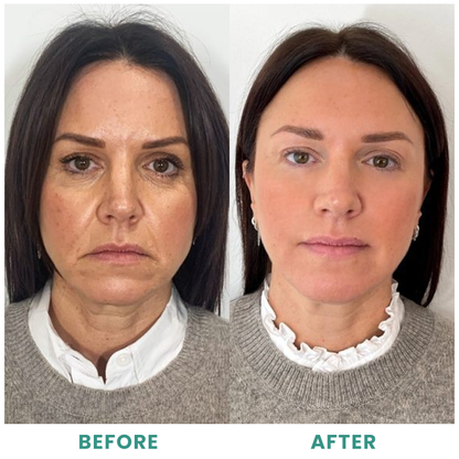 LIMETOW™ Collagen Serum