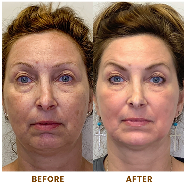 LIMETOW™ Collagen Face Toner