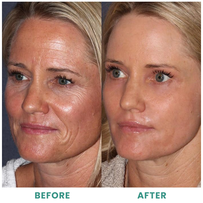 LIMETOW™ Collagen Serum
