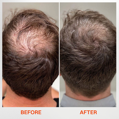 LIMETOW® - Korea's #1 Hair Growth Serum
