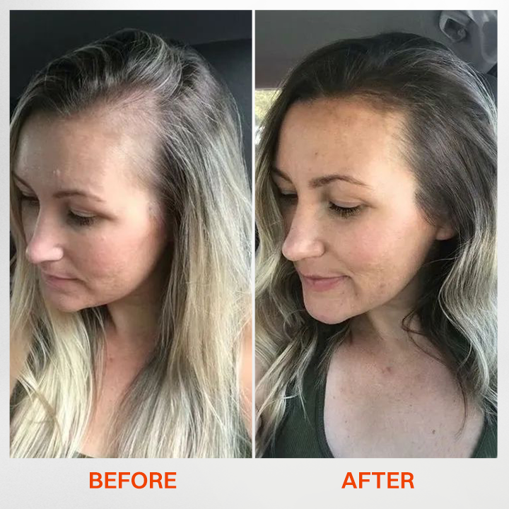 LIMETOW® - Korea's #1 Hair Growth Serum