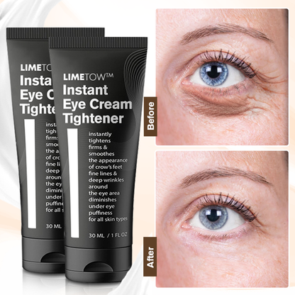 🔥New Product Discounts🔥 Last Day✨LIMETOW™ Instant Eye Cream Tightener