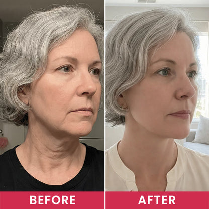 LIMETOW® Lift - Become the Woman Who Loves Her Neck Again