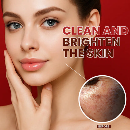 LIMETOW® Dark Spots Essence