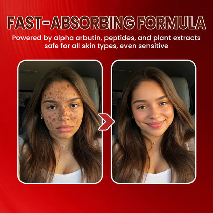 LIMETOW® Dark Spots Essence